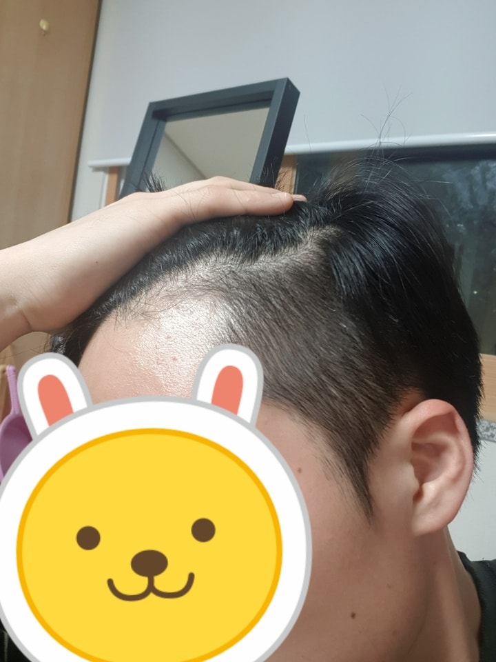 19.11.11 복용 5개월차