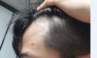 第5个月后期（记录用）