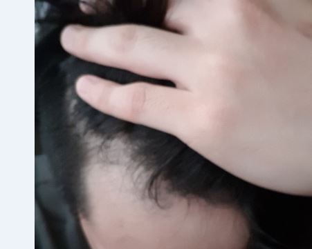 19.06.28 복용전 
