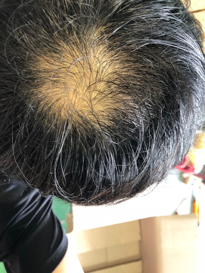 쉐딩 ㅠㅠ 8월7일