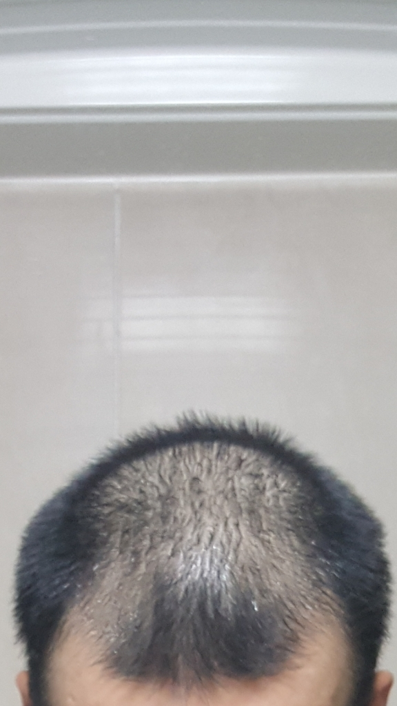 시작한지 2주쯤