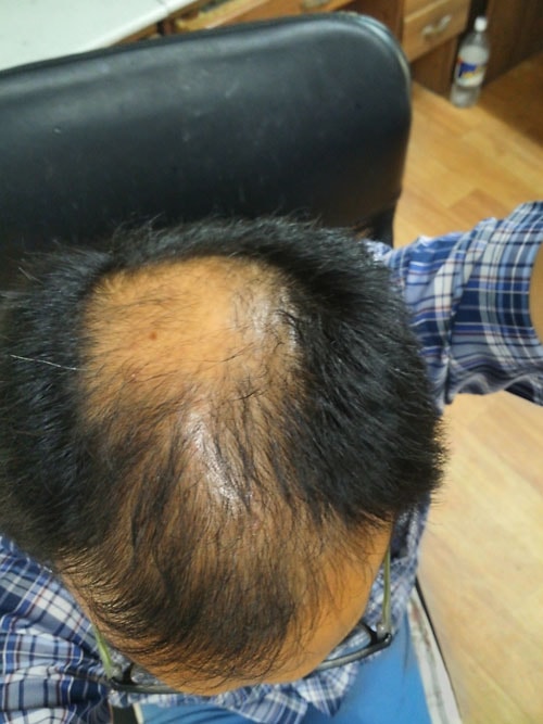 작년 4월 부터 현재까지의 변화입니다