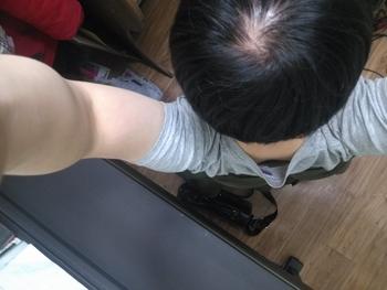 이건 약먹기 일주일전