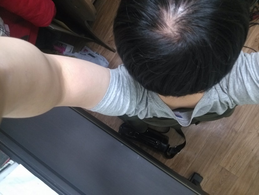 이건 약먹기 일주일전