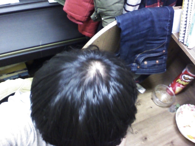 이건 일주일후 일주일전 동일한 위치에서 몬가 솜털같은게 자연스러워짐..