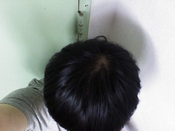 이것도 일주일후
