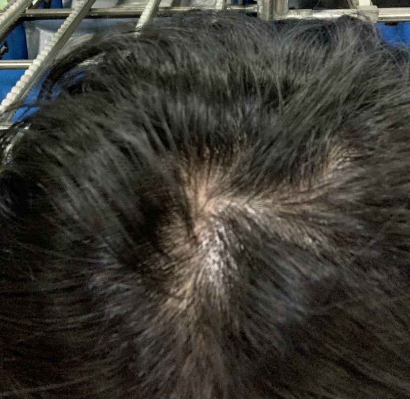 한창 머리 얇아졌을때 정수리 사진 입니다