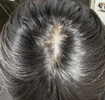 현재 모습입니다 형광등 바로 밑에서 찍은거라 양해 부탁드립니다.