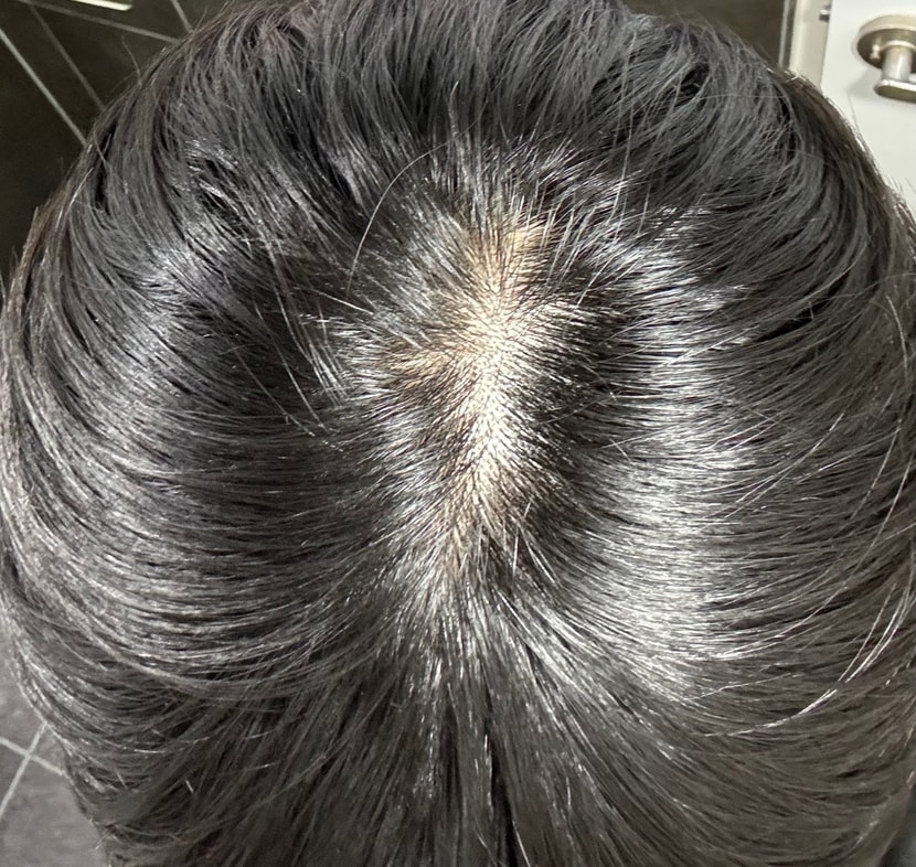 현재 모습입니다 형광등 바로 밑에서 찍은거라 양해 부탁드립니다.