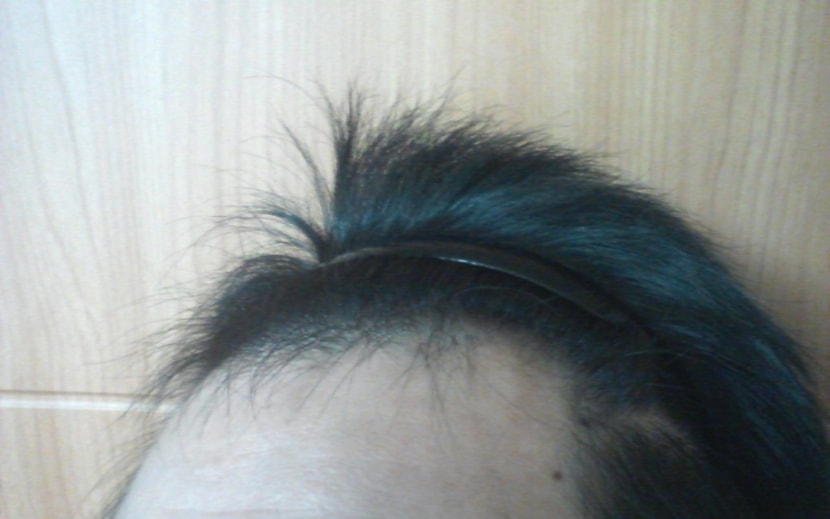 1달경과