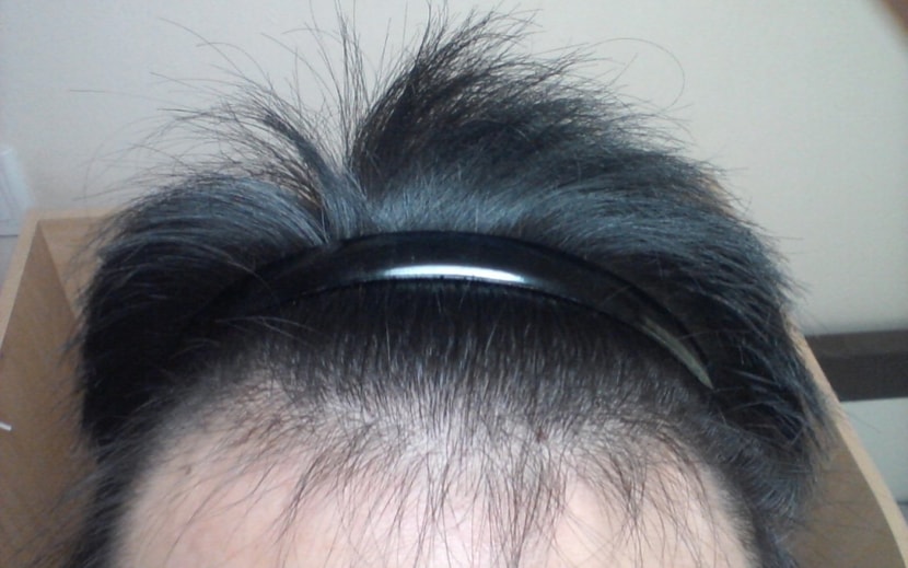 1달경과