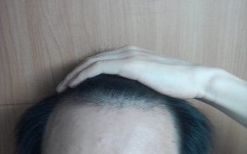 약먹기전