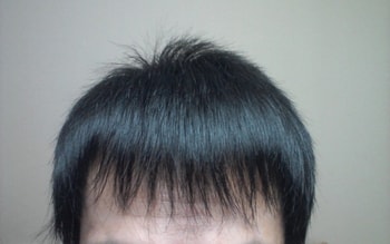 1달경과