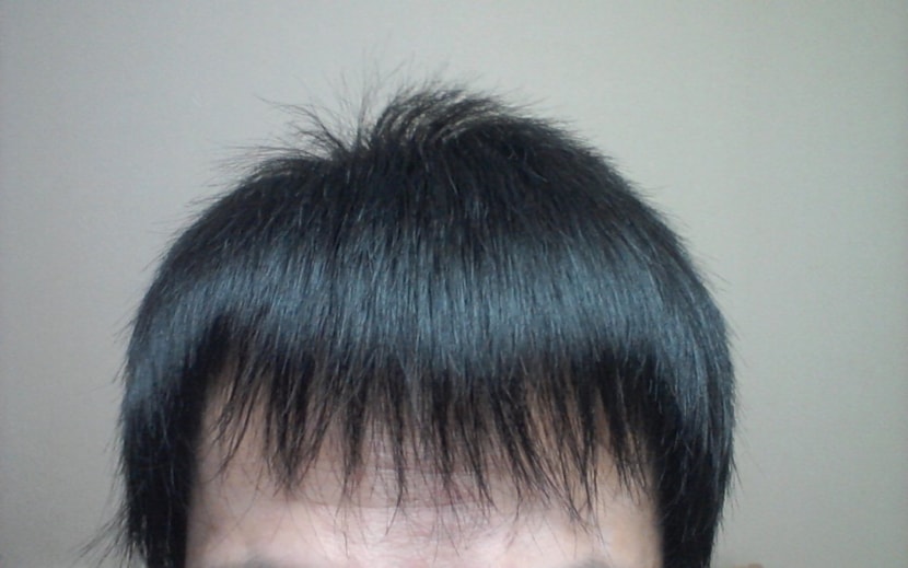 1달경과