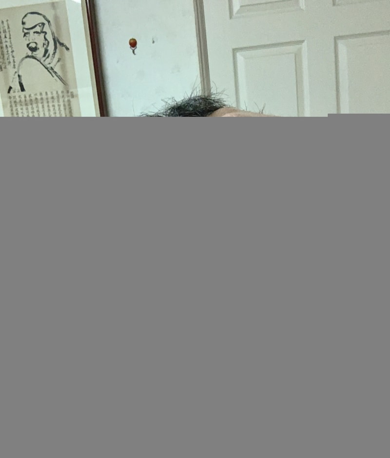 [피나 2년 8개월] [두타 4개월] M자 탈모 기록