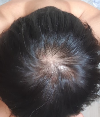 약복용하기전 사진입니다