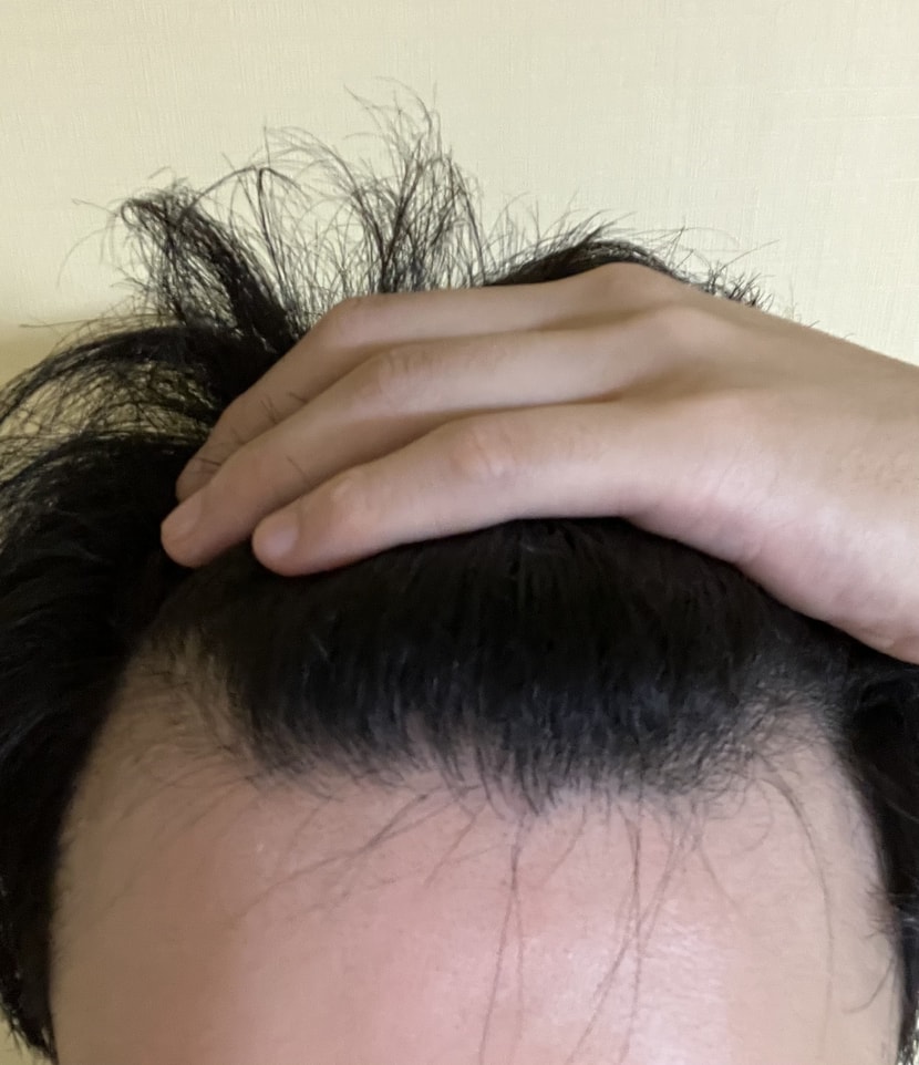 2023년 8월 1일에 찍은 사진