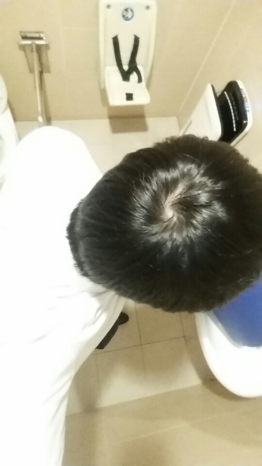 먹기 전 정수리 사진