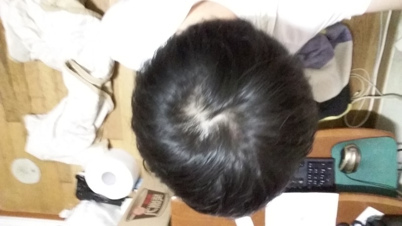 战胜麻烦地服用6个半月后记！