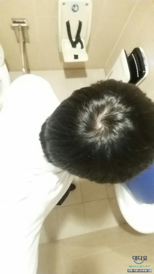 복용 전 사진