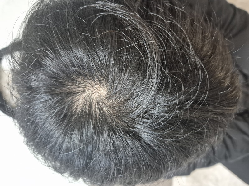 피나테크 -> 헤어그로정 후기