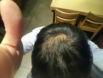 17년 8월