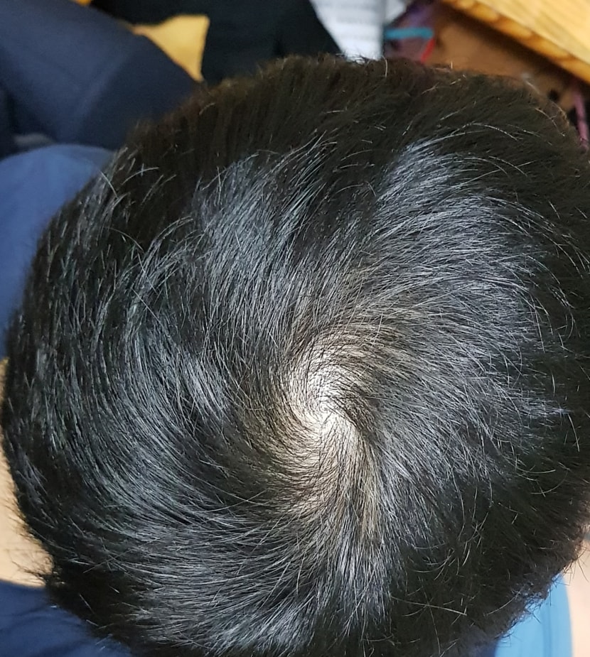 현재
