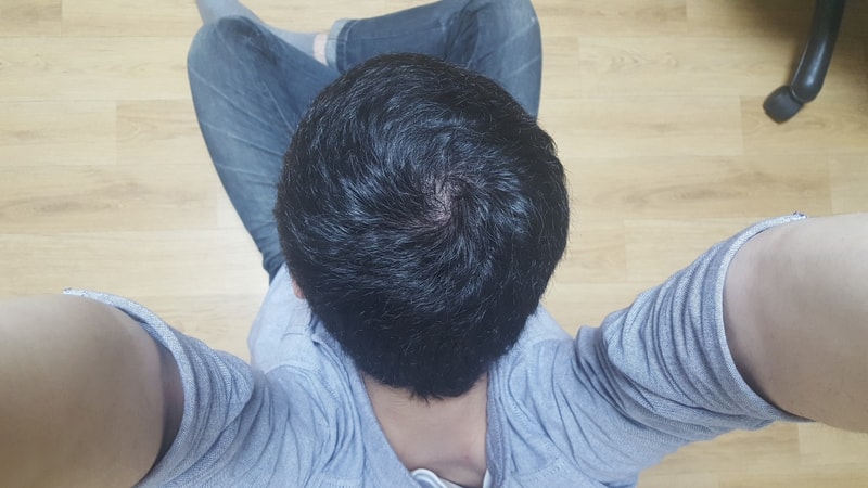 약 복용 270일차 입니다.