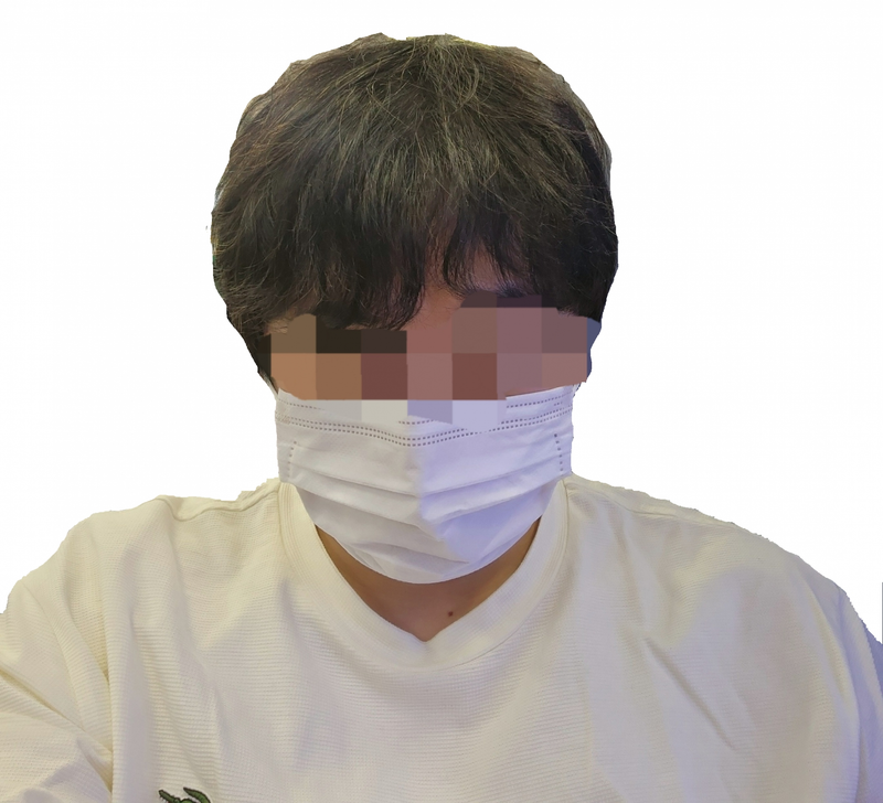미노페시아 + 로게인폼 3년 9개월 후기 남깁니다