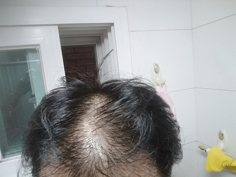 &lt;2018년 11월 복용시작&gt;