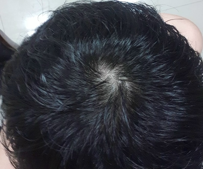 현재 상태