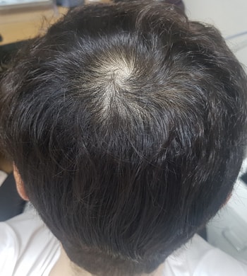 관리 한달차 상태입니다(0302)