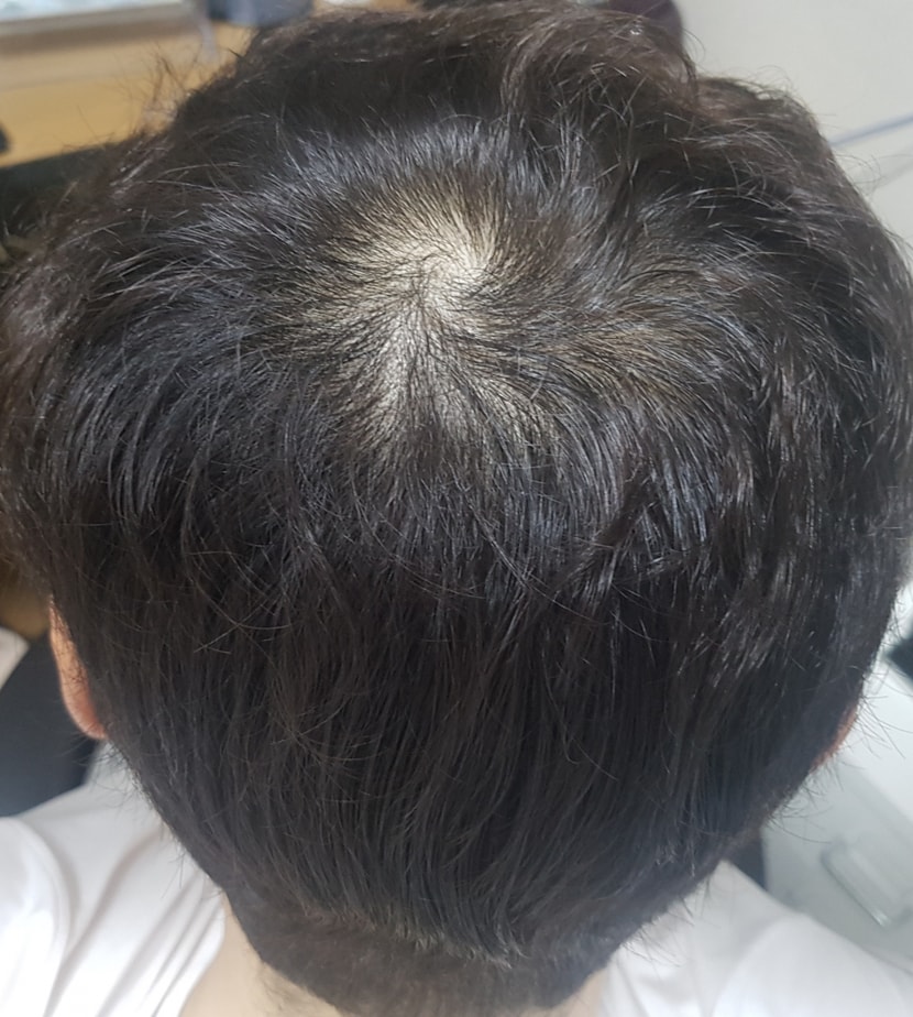 관리 한달차 상태입니다(0302)
