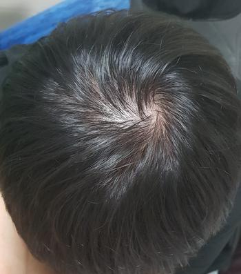 복용직전이었습니다