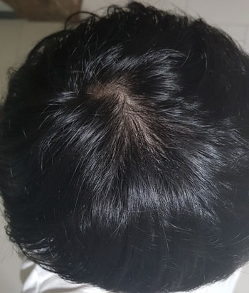 어제찍은사진입니다. 뭐 큰차이가있는지는모르겠지만 개인적으로 제가느끼기엔 모발의 굵기가 많이 굵어지고 힘이생겨서 축축처지는느낌이 많이 줄었습니다