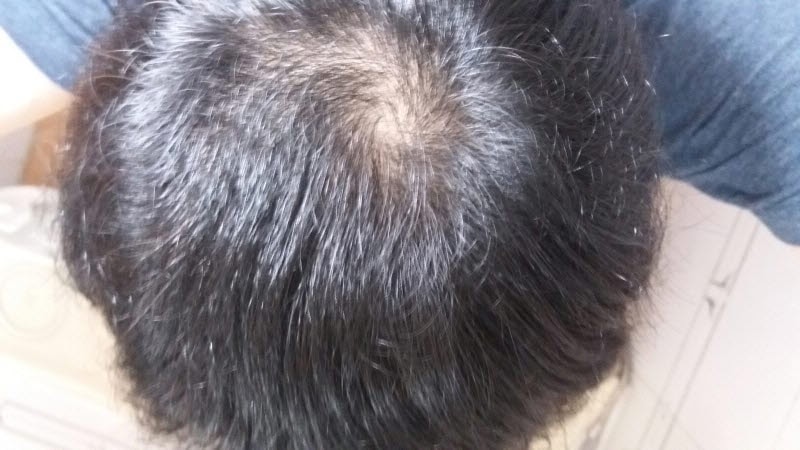 9월 머리감은 후 머리 앞으로 빗질