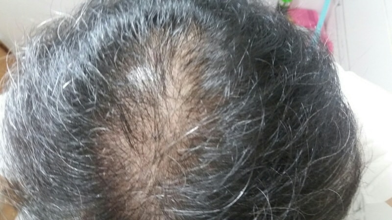 5월 머리 감은후 정수리