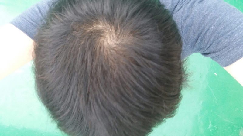 9월 머리감은 후 머리 앞으로 빗질 옥상에서