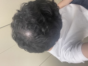 2개월 후