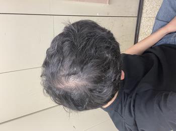 공포의 쉐딩기간