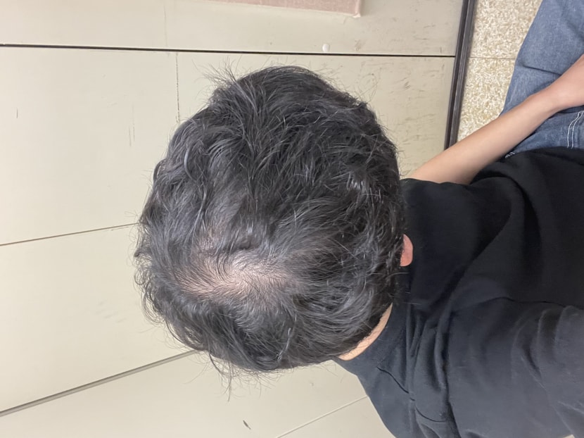 공포의 쉐딩기간