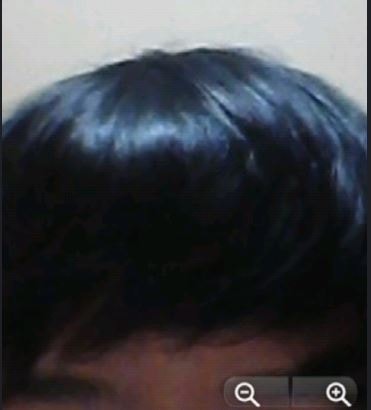 아보다트 +금연 8개월차..