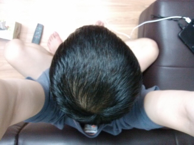 약먹은지 37일