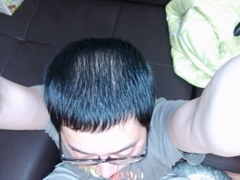 약먹은지37일