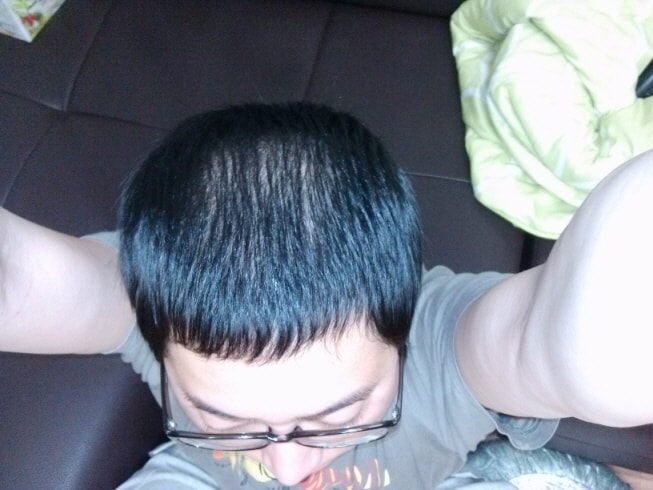 약먹은지37일