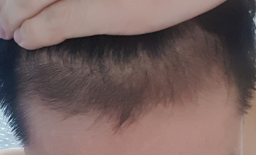 53일