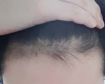 170일