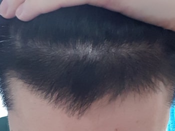 135일