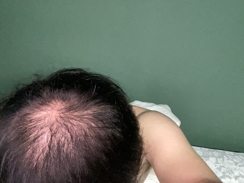 아보다트, 판시딜 1달