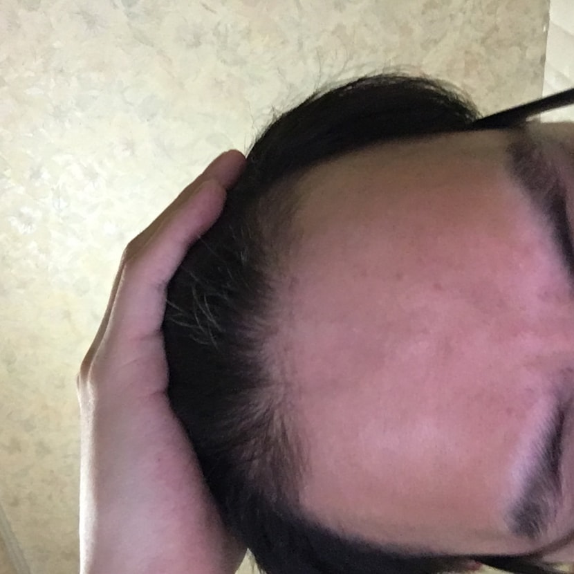 복용후4